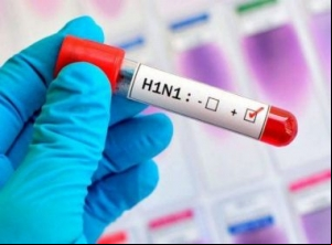 Quase metade das vÃ­timas fatais de H1N1 na BA em 2019 nÃ£o estava em faixa etÃ¡ria 'de risco'